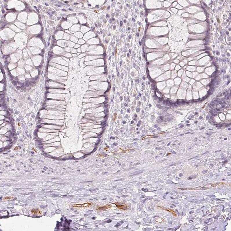 Staining of human rectum shows moderate membranous positivity in endothelial cells.