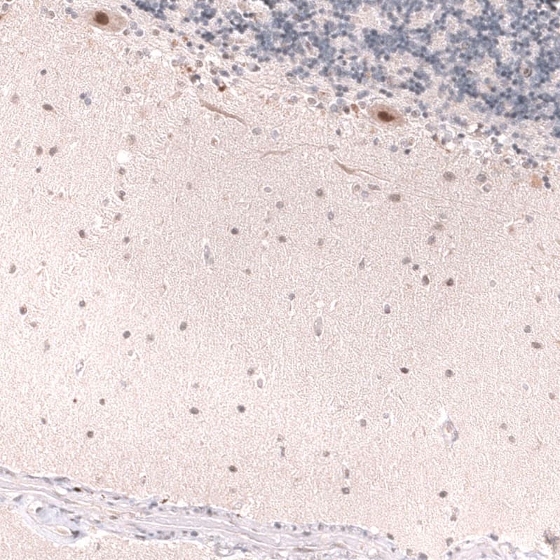 Staining of human cerebellum shows moderate nuclear positivity in Purkinje cells.
