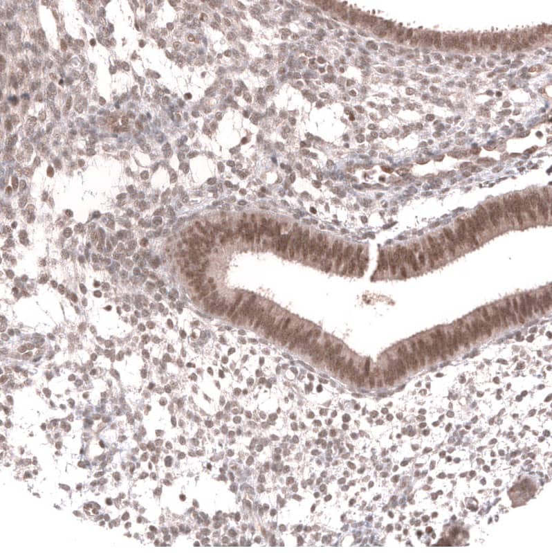 Staining of human endometrium shows moderate nuclear positivity in glandular and in stromal cells.