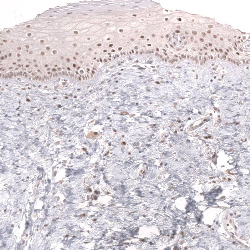 Staining of human uterine cervix shows moderate nuclear positivity in squamous epithelial cells.