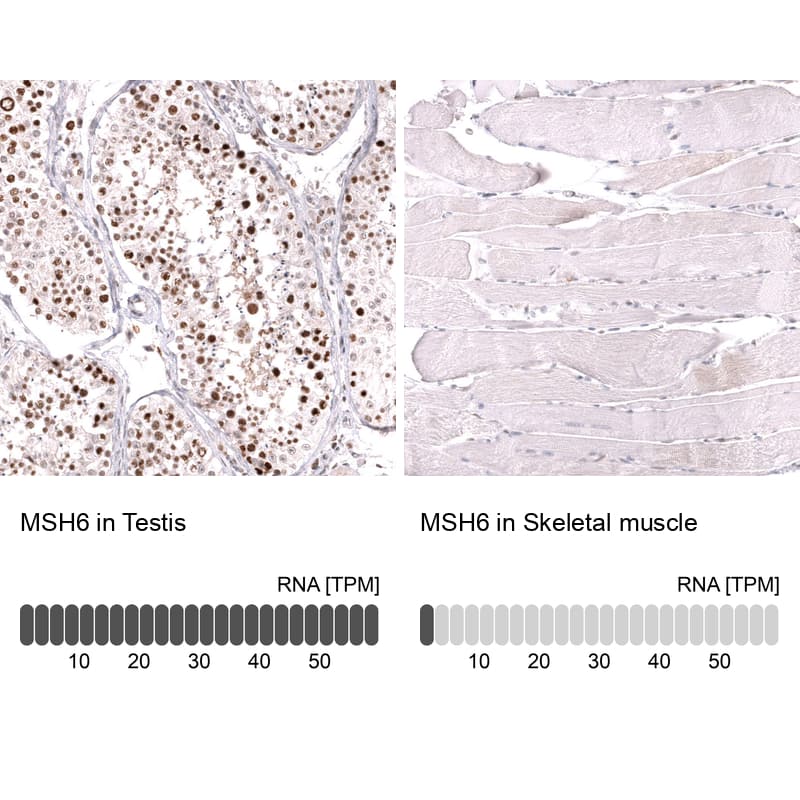 Analysis in human testis and skeletal muscle tissues using NBP3-43857 antibody. Corresponding MSH6 RNA-seq data are presented for the same tissues.