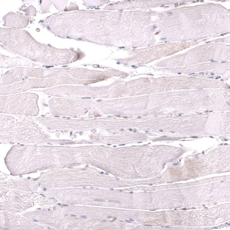Staining of human skeletal muscle shows no positivity in myocytes as expected.