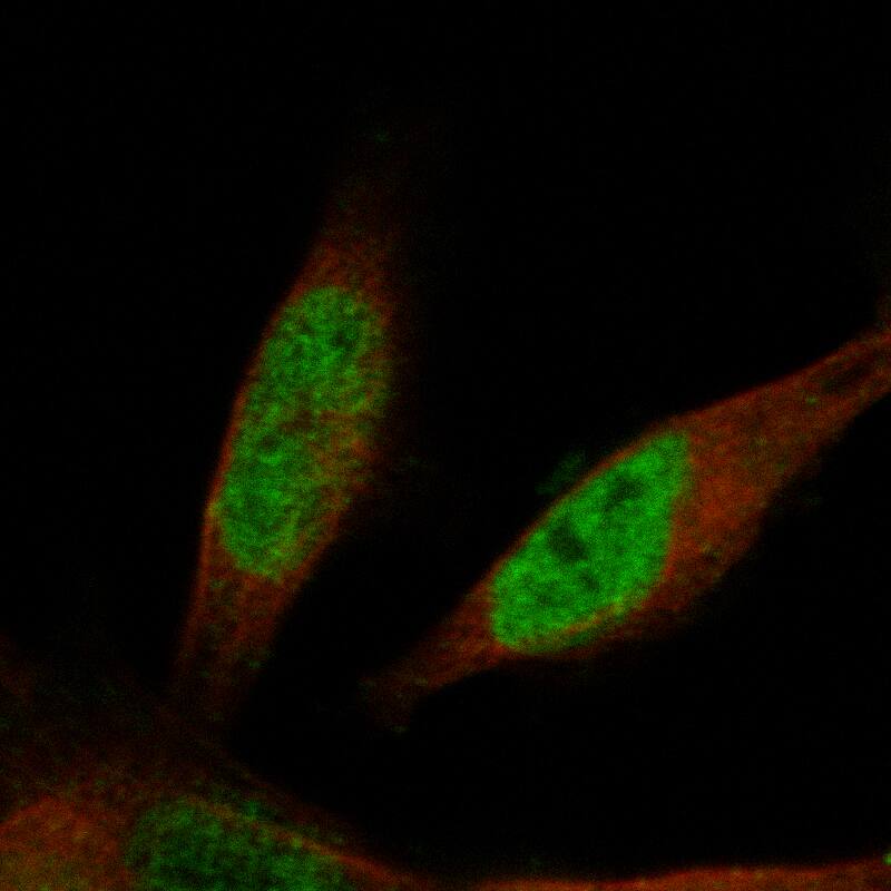 Staining in SH-SY5Y cell line with Anti-Prox1 monoclonal antibody) .