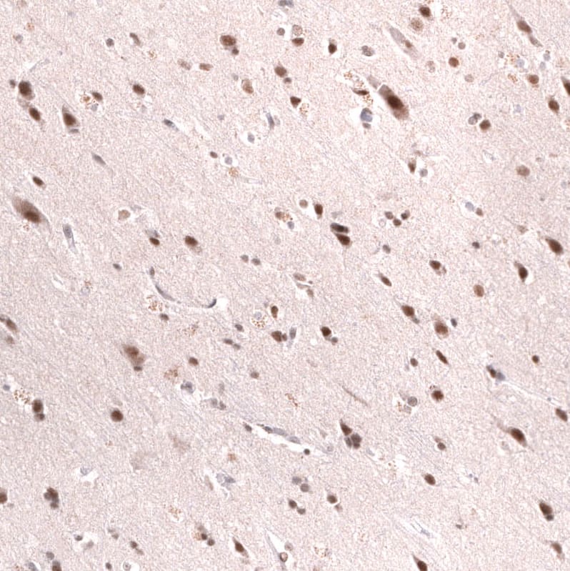 Staining of human cerebral cortex shows strong nuclear-cytoplasmic positivity in neurons.