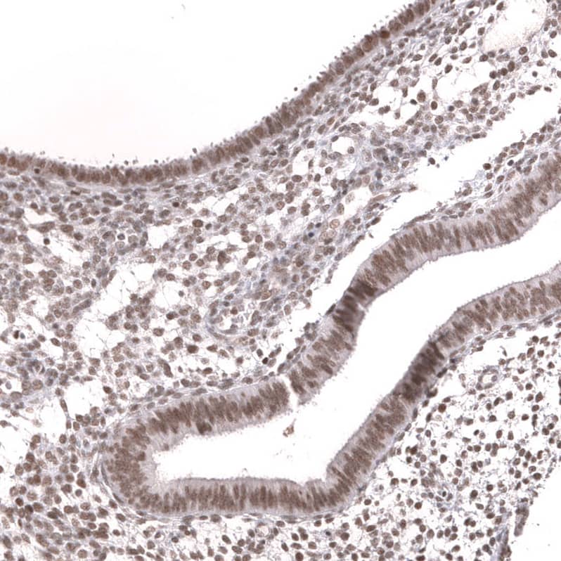 Staining of human endometrium shows moderate nuclear positivity in glandular cells and endometrium stromal cells.