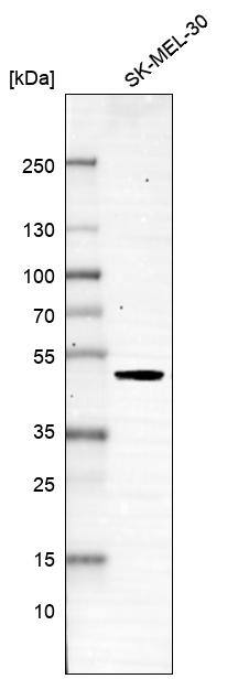 Analysis in human cell line SK-MEL-30.