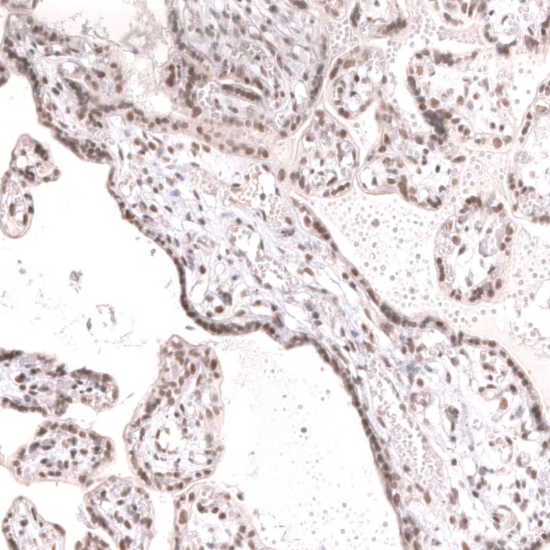Staining of human placenta shows moderate nuclear positivity in trophoblastic cells.
