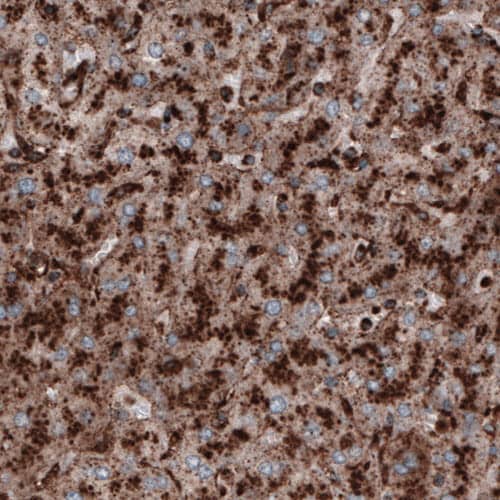 Staining of human liver shows strong granular cytoplasmic positivity in hepatocytes.