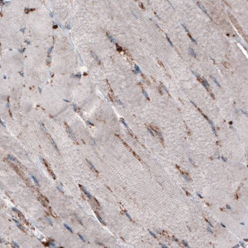 Staining of human skeletal muscle shows only very low cytoplasmic immunoreactivity.