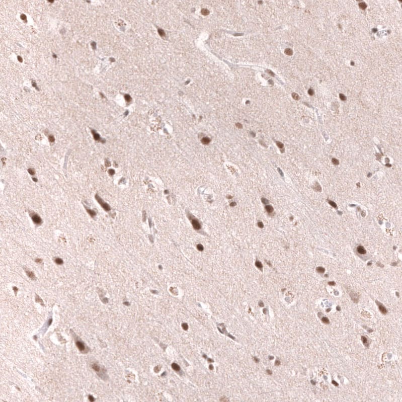 Staining of human cerebral cortex shows strong nuclear positivity in neurons.