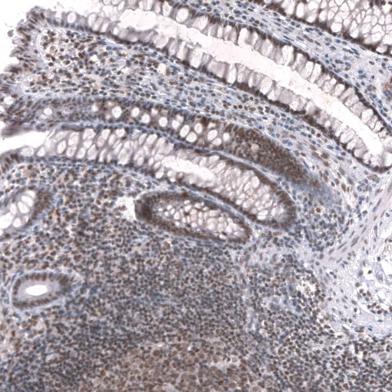 Staining of human rectum shows strong nuclear positivity in glandular cells and lymphoid cells.