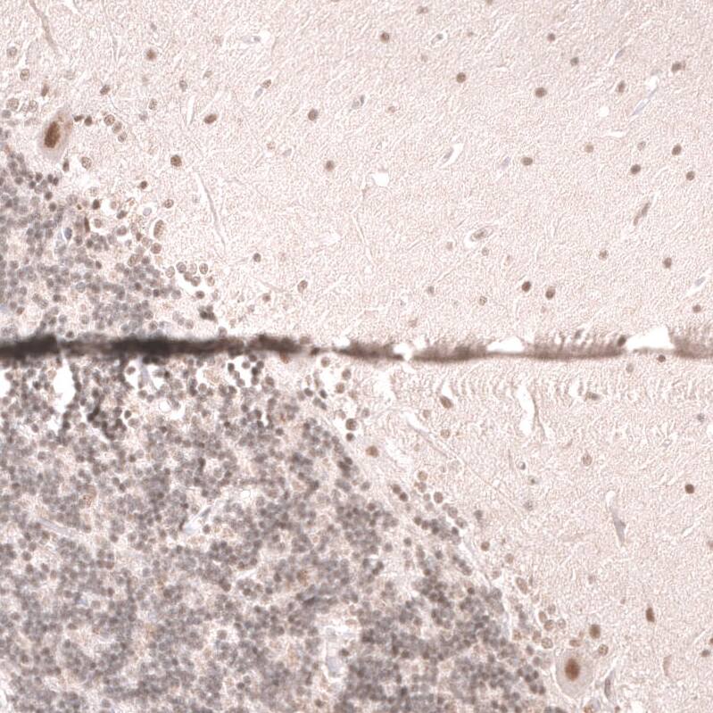 Staining of human cerebellum shows moderate nuclear positivity in Purkinje cells.