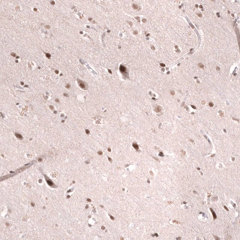 Staining of human cerebral cortex shows strong nuclear positivity in neurons.