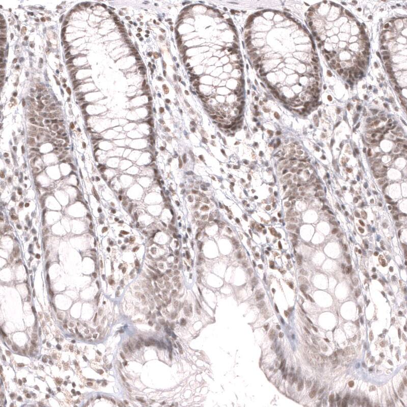 Staining of human rectum shows moderate nuclear positivity in glandular and lymphoid cells.