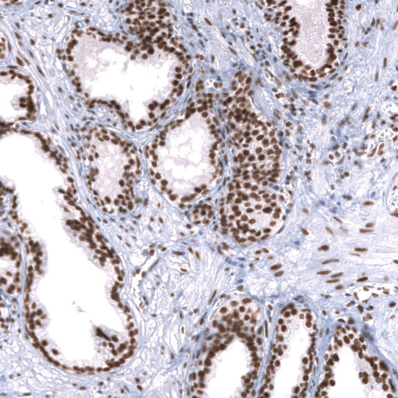 Staining of human prostate shows strong nuclear positivity in glandular cells.
