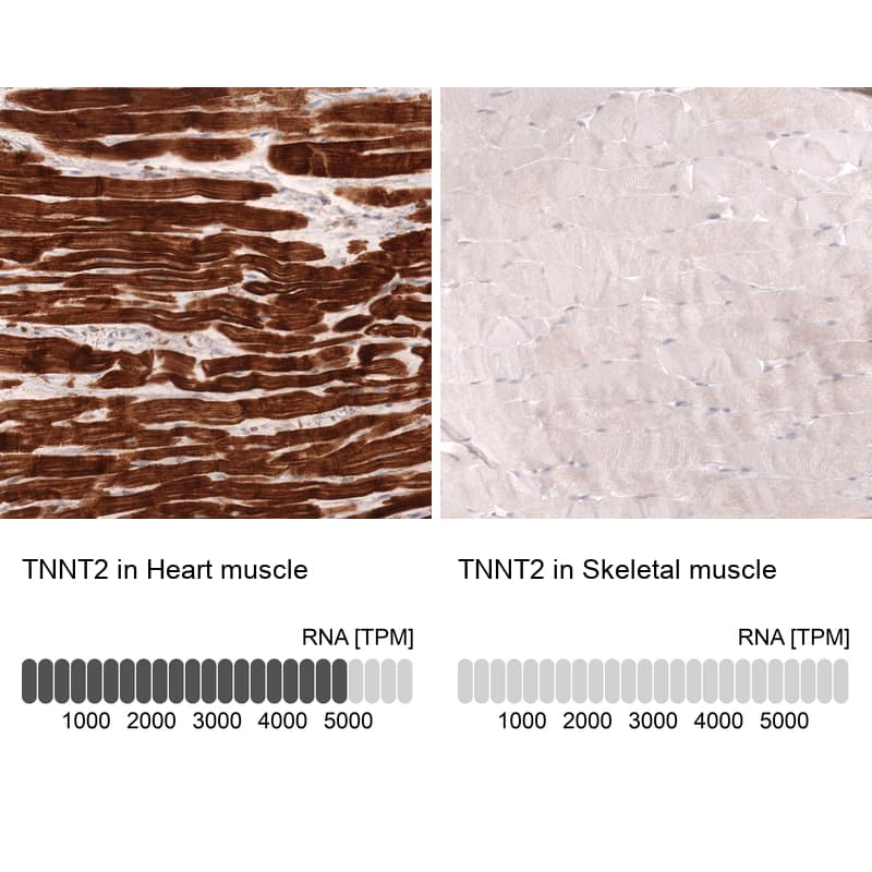 <b>Orthogonal Strategies Validation. </b>Analysis in human heart muscle and skeletal muscle tissues using NBP3-43866 antibody. Corresponding Troponin T Type 2 (cardiac) RNA-seq data are presented for the same tissues.