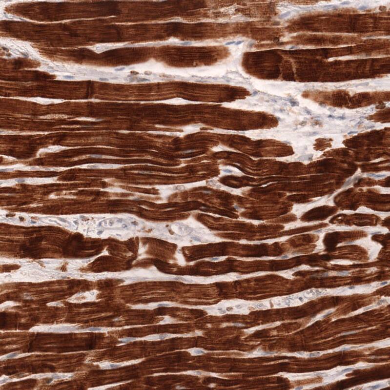 Staining of human heart muscle shows strong cytoplasmic positivity in cardiomyocytes.