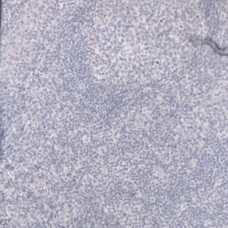 Staining of human tonsil shows no positivity in non-germinal center cells as expected.