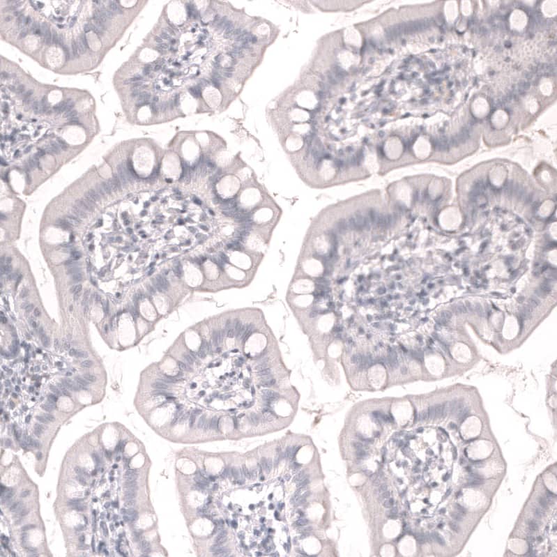 Staining of human small intestine shows no positivity in glandular cells as expected.