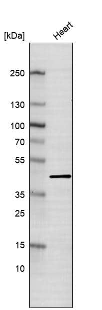 Analysis in human heart tissue.