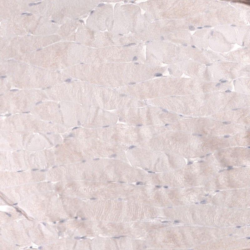Staining of human skeletal muscle shows negative to very weak cytoplasmic positivity in myocytes.