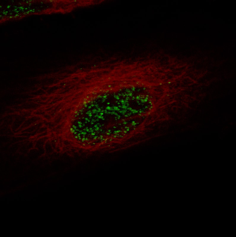 Staining in U-87 cell line with Anti-ZEB2 monoclonal antibody) .