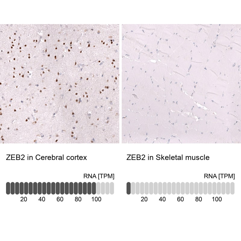 Analysis in human cerebral cortex and skeletal muscle tissues using NBP3-43869 antibody. Corresponding ZEB2 RNA-seq data are presented for the same tissues.