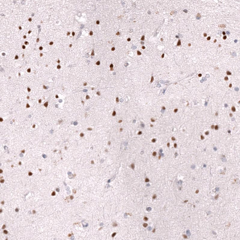 Staining of human cerebral cortex shows strong nuclear positivity in neurons.