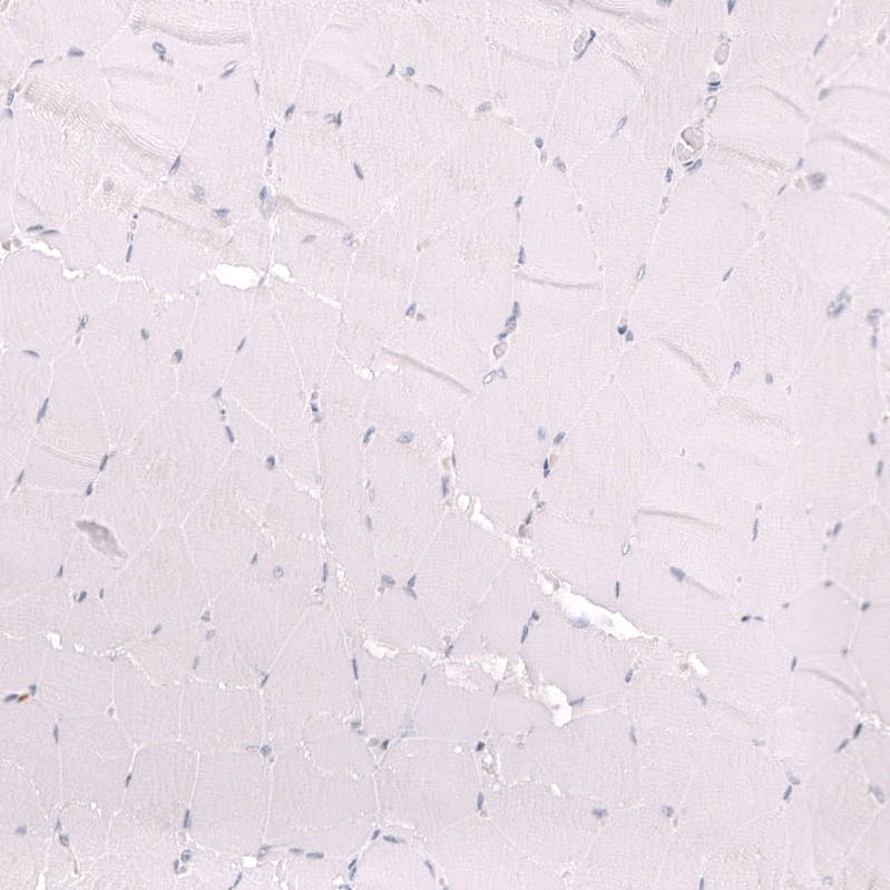 Staining of human skeletal muscle shows no positivity in myocytes as expected.