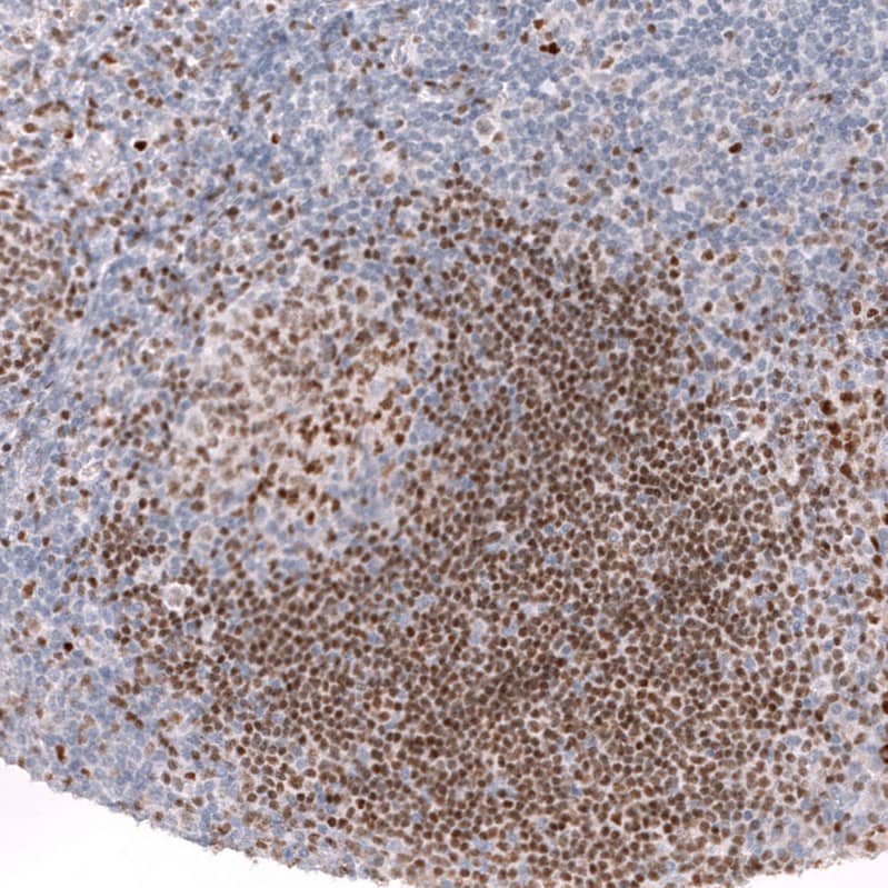 Staining of human tonsil shows strong nuclear positivity in germinal center cells.