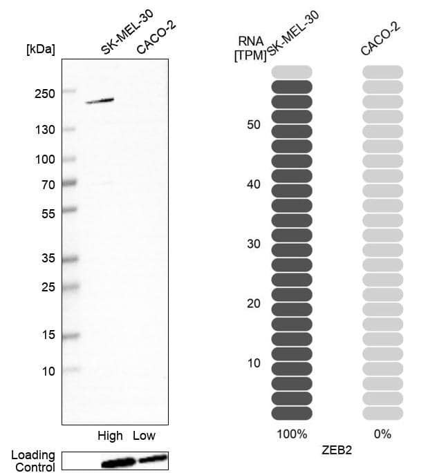 Analysis in human cell lines SK-MEL-30 and Caco-2 using Anti-ZEB2 antibody. Corresponding ZEB2 RNA-seq data are presented for the same cell lines. Loading control: Anti-HDAC1.