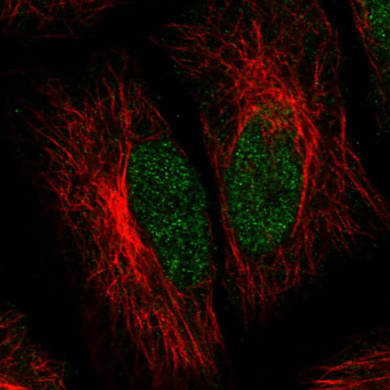 Staining in A431 cell line with Anti-ATRX monoclonal antibody, showing clear nuclear (without nucleoli) staining in green. Microtubule- and nuclear probes are visualized in red and blue respectively (where available).