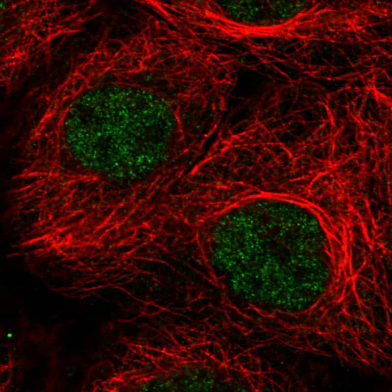 Staining in A431 cell line with Anti-ATRX monoclonal antibody) staining in green. Microtubule- and nuclear probes are visualized in red and blue respectively (where available).