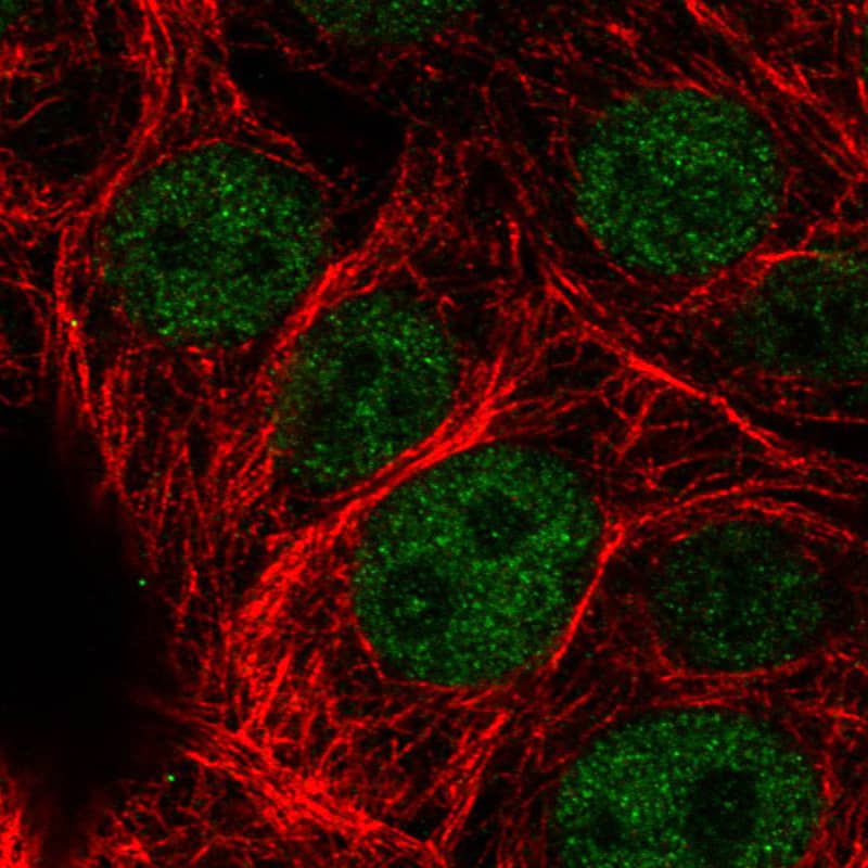 Staining in MCF7 cell line with Anti-ATRX monoclonal antibody) staining in green. Microtubule- and nuclear probes are visualized in red and blue respectively (where available).