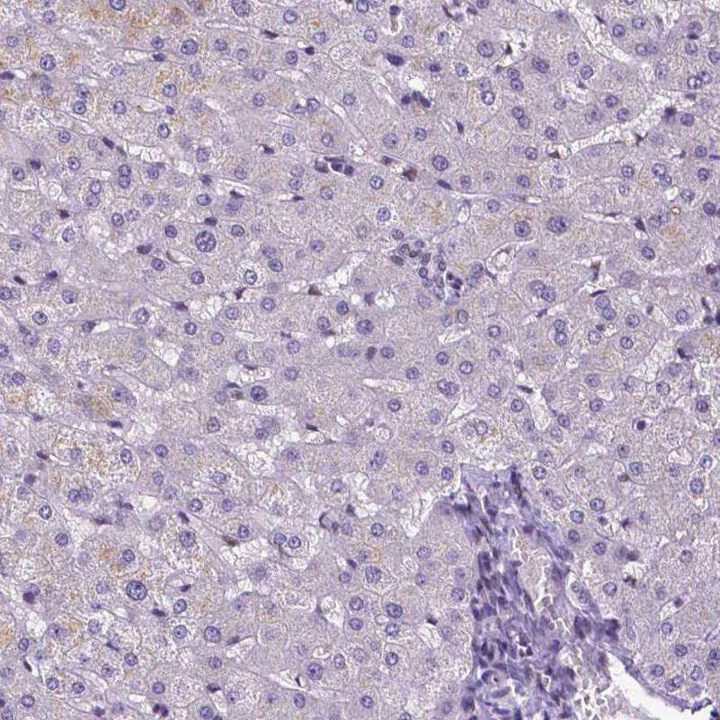 Staining of human liver shows no positivity in hepatocytes as expected.