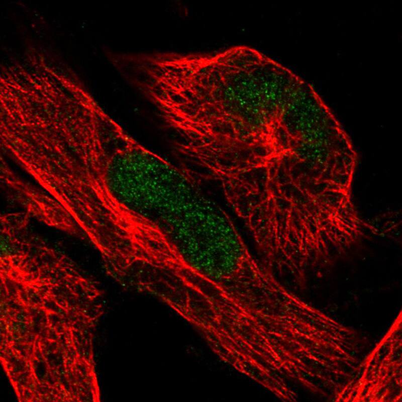 Staining in U251 cell line with Anti-ATRX monoclonal antibody) staining in green. Microtubule- and nuclear probes are visualized in red and blue respectively (where available).