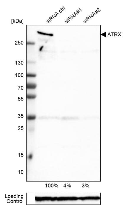 Analysis in A-549 cells transfected with control siRNA, target specific siRNA probe #1 and #2, using Anti-ATRX antibody. Remaining relative intensity is presented. Loading control: Anti-GAPDH.