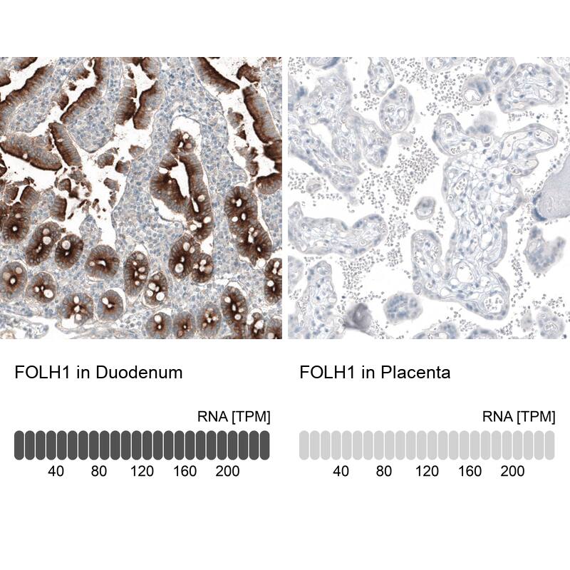 Analysis in human duodenum and placenta tissues using NBP3-43873 antibody. Corresponding PSMA/FOLH1/NAALADase I RNA-seq data are presented for the same tissues.