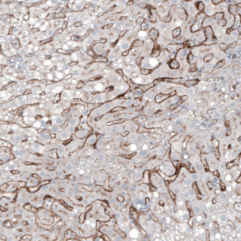 Staining of human liver shows moderate membranous positivity in hepatocytes.