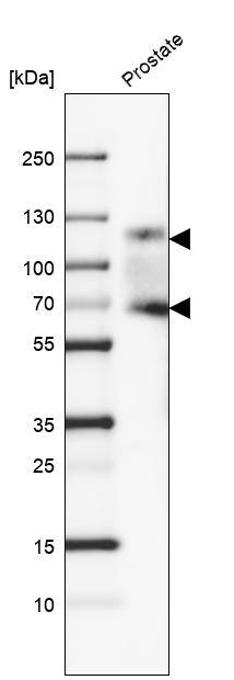 Analysis in human prostate tissue.