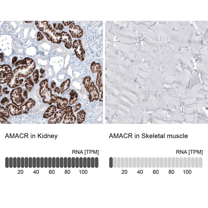 Analysis in human kidney and skeletal muscle tissues using NBP3-43875 antibody. Corresponding alpha-Methylacyl-CoA Racemase/AMACR RNA-seq data are presented for the same tissues.