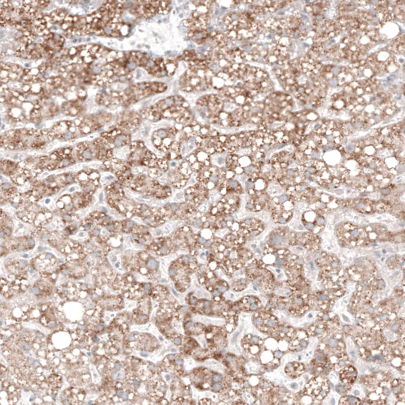 <b>Orthogonal Strategies Validation. </b>Staining of human liver shows moderate granular cytoplasmic positivity in hepatocytes.