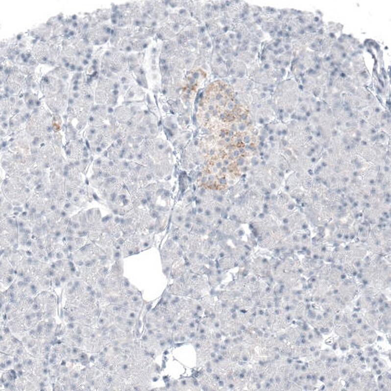 Staining of human pancreas shows weak granular cytoplasmic positivity in islets of Langerhans.