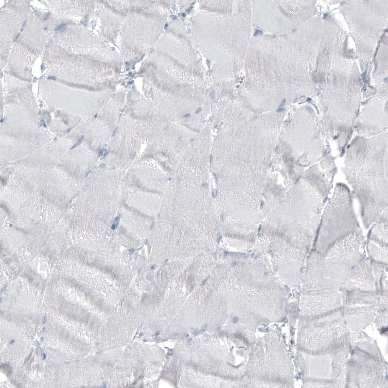 Staining of human skeletal muscle shows no positivity in myocytes as expected.