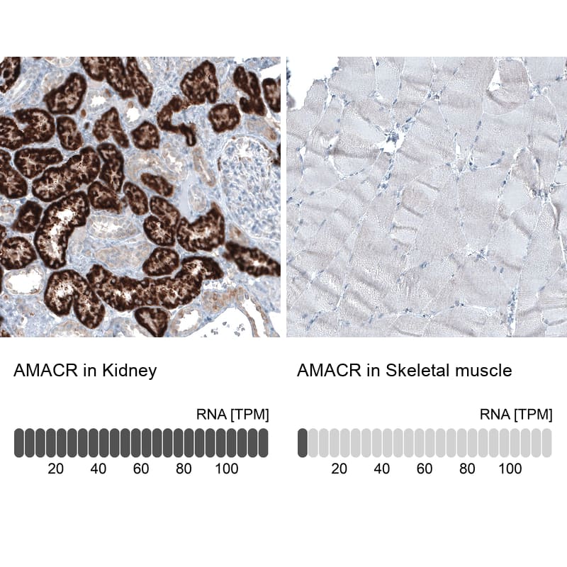 Analysis in human kidney and skeletal muscle tissues using NBP3-43876 antibody. Corresponding alpha-Methylacyl-CoA Racemase/AMACR RNA-seq data are presented for the same tissues.