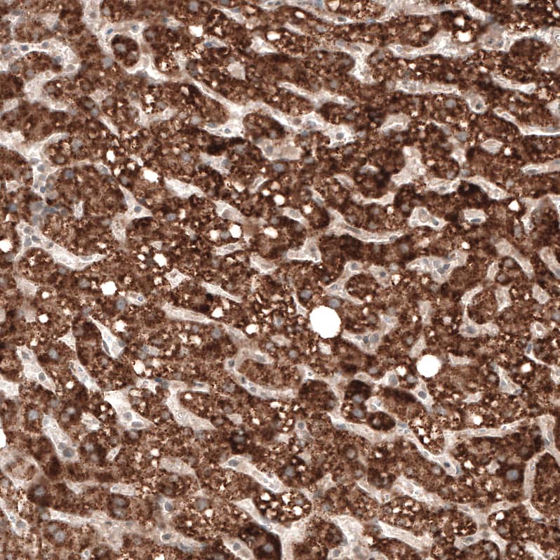 Staining of human liver shows strong granular cytoplasmic positivity in hepatocytes.