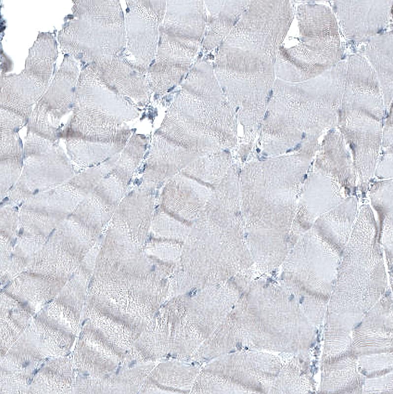 Staining of human skeletal muscle shows no positivity in myocytes as expected.