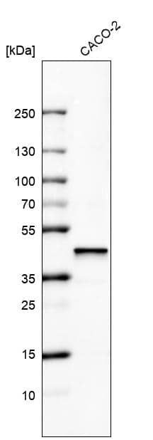 Analysis in human cell line CACO-2.