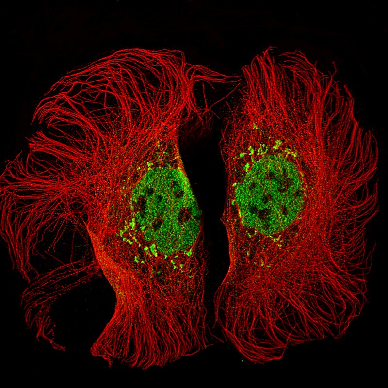 Staining of CACO-2 cells using the Anti-KMT2D monoclonal antibody) . 