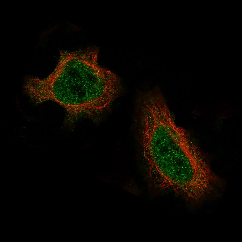 Staining of HeLa cells using the Anti-Daxx monoclonal antibody) .